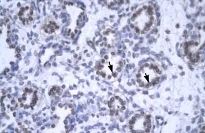 Immunohistochemistry-Paraffin: GAS41 Antibody [NBP3-10887]