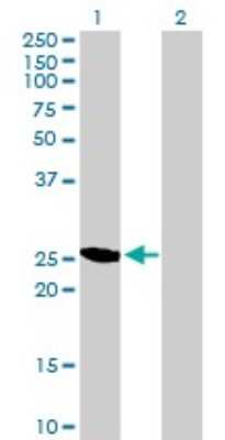 Western Blot: GAS41 Antibody [H00008089-B02P]