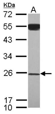 Western Blot: GAS41 Antibody [NBP2-16609]