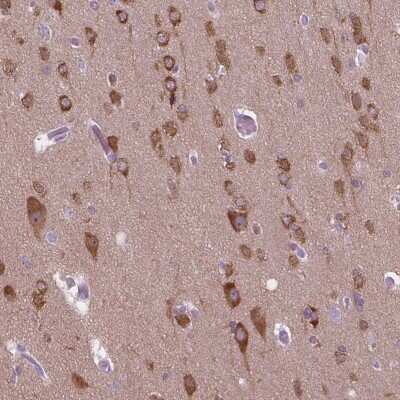 Immunohistochemistry-Paraffin: GAS7 Antibody [NBP2-48498]