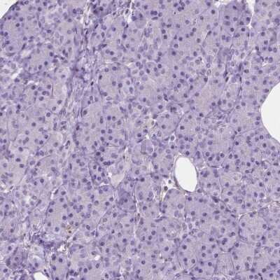 Immunohistochemistry-Paraffin: GAS7 Antibody [NBP2-48498]