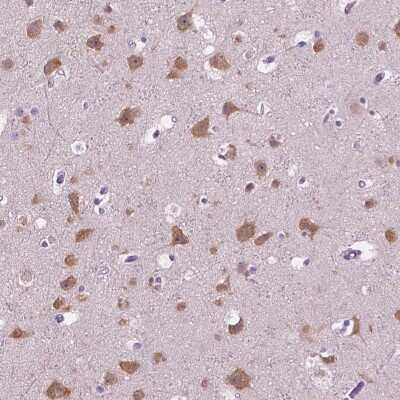 Immunohistochemistry-Paraffin: GAS7 Antibody [NBP2-49422]