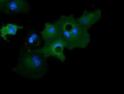 Immunocytochemistry/ Immunofluorescence: GAS7 Antibody (OTI2F6) - Azide and BSA Free [NBP2-71376]