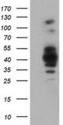 Western Blot: GAS7 Antibody (OTI2F6)Azide and BSA Free [NBP2-71376]