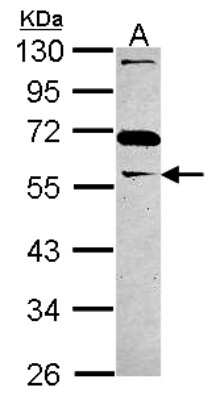 Western Blot: GAS7 Antibody [NBP2-14965]