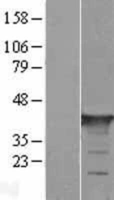 Western Blot: GAS7 Overexpression Lysate [NBL1-10976]