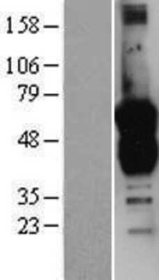 Western Blot: GAS7 Overexpression Lysate [NBP2-04580]