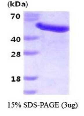 SDS-PAGE: Recombinant Human GAS7 His Protein [NBC1-22933]