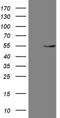 Western Blot: GAS8 Antibody (OTI10G2) [NBP2-45809]