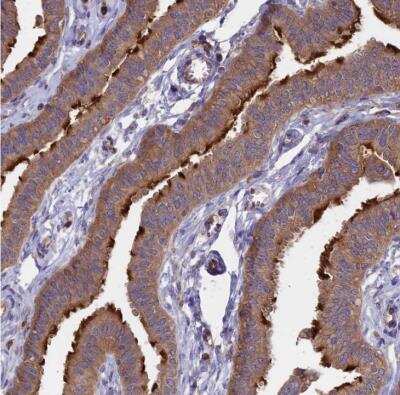 Immunohistochemistry-Paraffin: GAS8 Antibody [NBP2-14037]