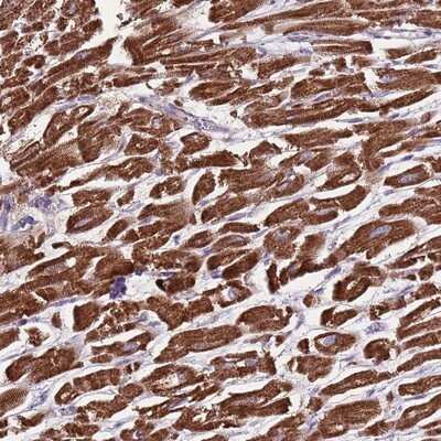 Immunohistochemistry-Paraffin: GAS8 Antibody [NBP2-14038]