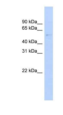 Western Blot: GAS8 Antibody [NBP1-55497]