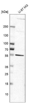 Western Blot: GAS8 Antibody [NBP2-14037]