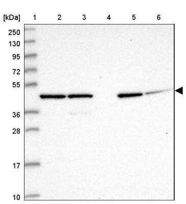 Western Blot: GAS8 Antibody [NBP2-14038]