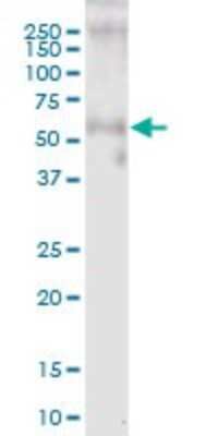 Western Blot: GASP-1/WFIKKN2 Antibody [H00124857-B01P]