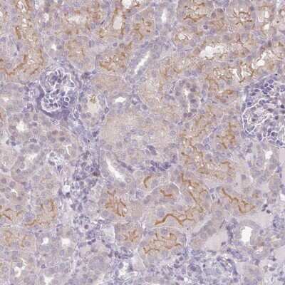 Immunohistochemistry: GASP-2/WFIKKN Antibody [NBP2-37910]