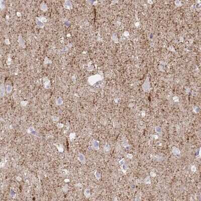 Immunohistochemistry-Paraffin: GAT-1/SLC6A1 Antibody [NBP1-89802]