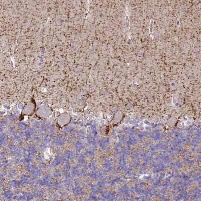 Immunohistochemistry-Paraffin: GAT-1/SLC6A1 Antibody [NBP1-89802]