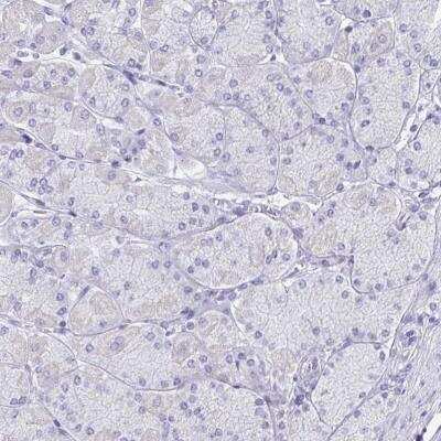 Immunohistochemistry-Paraffin: GAT-1/SLC6A1 Antibody [NBP1-89802]