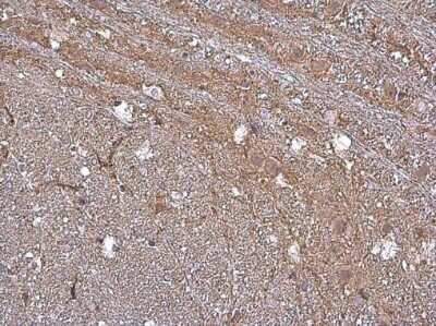 Immunohistochemistry-Paraffin: GAT-1/SLC6A1 Antibody [NBP3-13166]