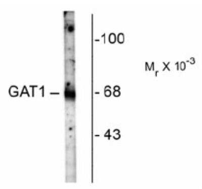 Western Blot: GAT-1/SLC6A1 Antibody [NB100-61097]