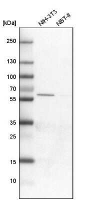 Western Blot: GAT-1/SLC6A1 Antibody [NBP1-89802]