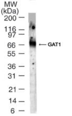 Western Blot: GAT-1/SLC6A1 Antibody [NBP2-25078]