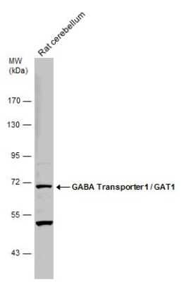 Western Blot: GAT-1/SLC6A1 Antibody [NBP3-13166]