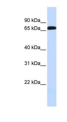 Western Blot: GAT-1/SLC6A1 Antibody [NBP1-59878]