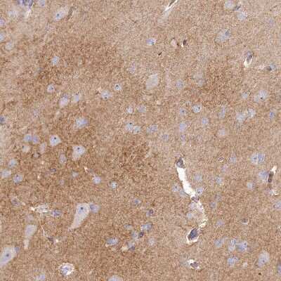 Immunohistochemistry-Paraffin: GAT3 Antibody [NBP1-91920]