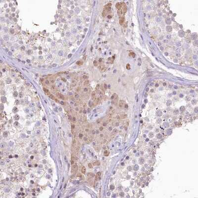 Immunohistochemistry-Paraffin: GAT3 Antibody [NBP1-91920]