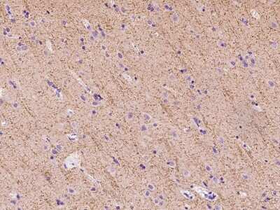 Immunohistochemistry-Paraffin: GAT3 Antibody [NBP2-97671]