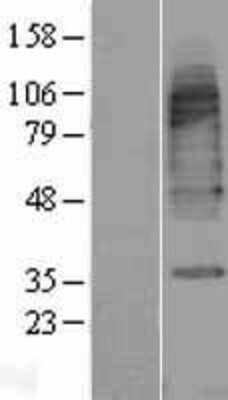 Western Blot: GAT3 Overexpression Lysate [NBP2-10333]
