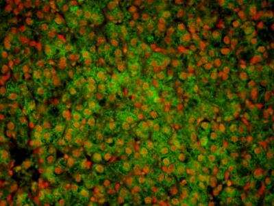 Immunohistochemistry: GATA-1 Antibody (4F5) - BSA Free [NBP1-47492]