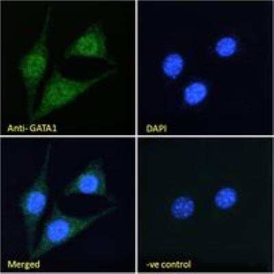 Immunocytochemistry/ Immunofluorescence: GATA-1 Antibody [NB100-2443]