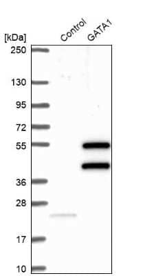 Western Blot: GATA-1 Antibody [NBP1-84793]