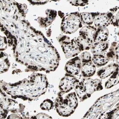 Immunohistochemistry-Paraffin: GATA-2 Antibody [NBP1-82581]