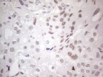 Immunohistochemistry: GATA-3 Antibody (OTI8H4) [NBP2-45810]