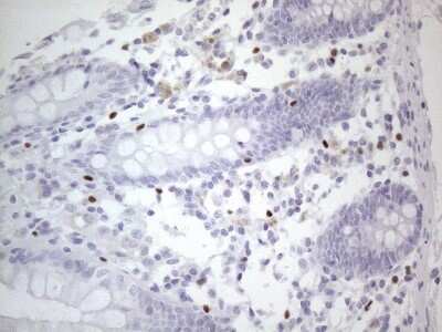 Immunohistochemistry: GATA-3 Antibody (OTI8H4) [NBP2-45810]