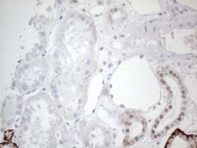 Immunohistochemistry: GATA-3 Antibody (OTI8H4) [NBP2-45810]