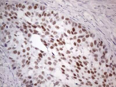 Immunohistochemistry: GATA-3 Antibody (OTI8H4) [NBP2-45810]