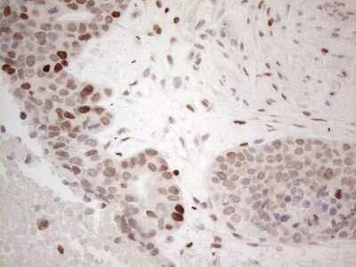 Immunohistochemistry: GATA-3 Antibody (OTI8H4) [NBP2-45810]