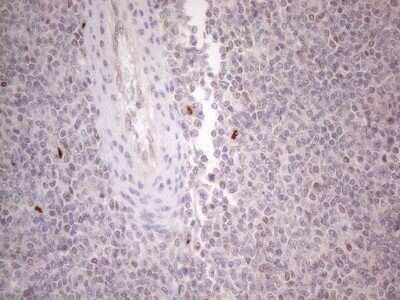 Immunohistochemistry: GATA-3 Antibody (OTI8H4) [NBP2-45810]