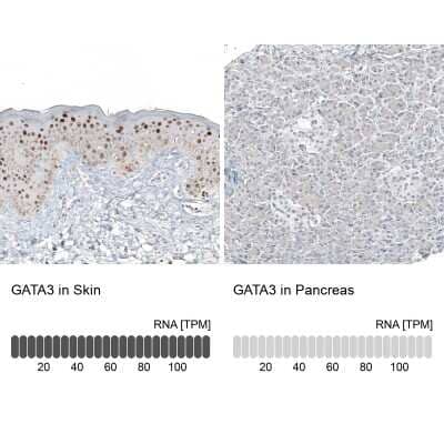 Immunohistochemistry-Paraffin: GATA-3 Antibody (CL8660) [NBP2-88917]