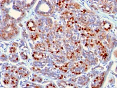 Immunohistochemistry-Paraffin: GATA-3 Antibody (GATA3/2442) - Azide and BSA Free [NBP3-08401]