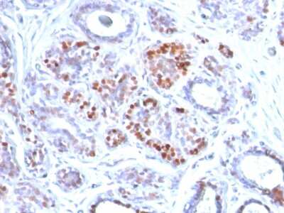 Immunohistochemistry-Paraffin: GATA-3 Antibody (GATA3/2442) - Azide and BSA Free [NBP3-08401]