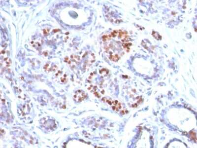 Immunohistochemistry-Paraffin: GATA-3 Antibody (GATA3/2442) [NBP3-07661]