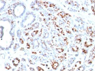 Immunohistochemistry-Paraffin: GATA-3 Antibody (GATA3/2444) [NBP3-07662]