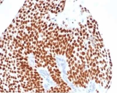 Immunohistochemistry-Paraffin: GATA-3 Antibody (GATA3/4550R) [NBP3-13922]