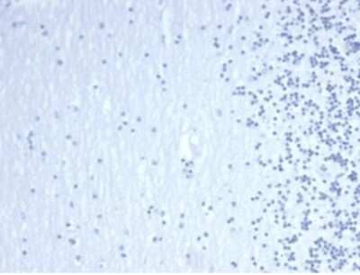 Immunohistochemistry-Paraffin: GATA-3 Antibody (GATA3/4550R) [NBP3-13922]